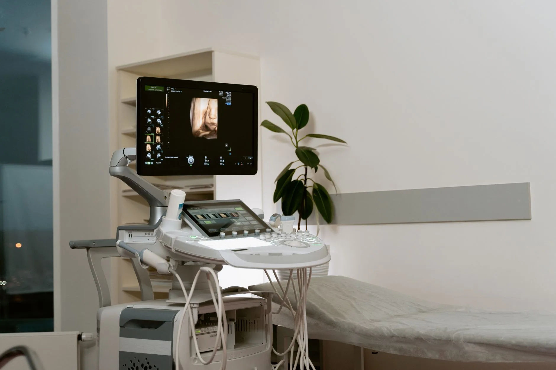 Phase Two: Ovarian Stimulation, Monitoring, and Egg Retrieval advanced ultrasound machine used for medical monitoring during fertility treatments